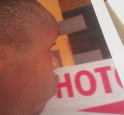 Chikwado-Omokwa-whose-ear-was-biten-off-by-Woman2